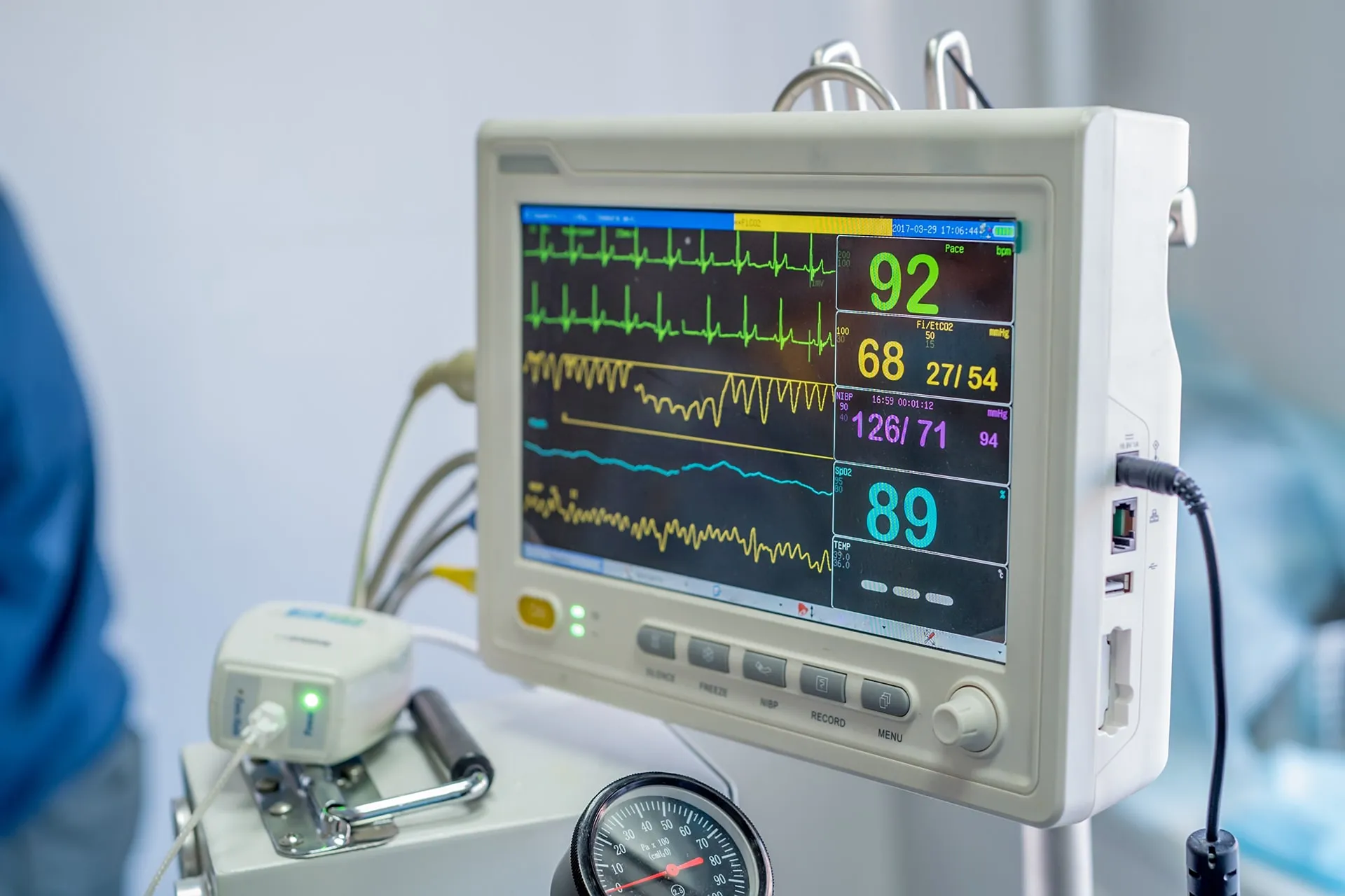 Anesthetic Monitoring